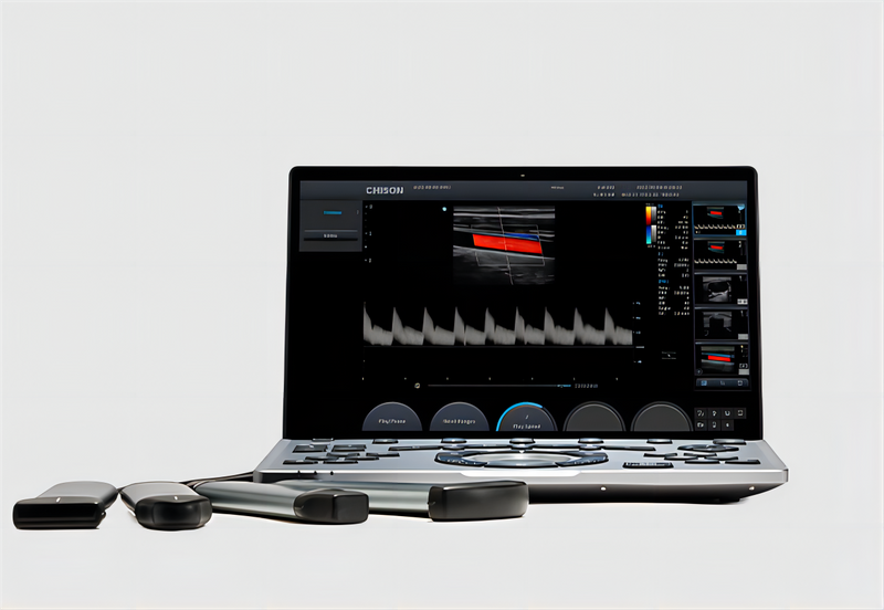 SonoAir 60 Lighter Smarter and Faster