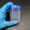 Disposable plastic urine container 100ml urine specimen cup