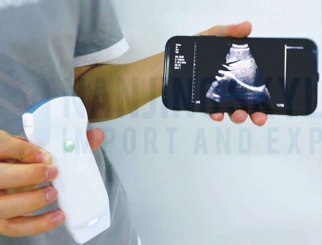 3 in 1 color doppler ultrasound